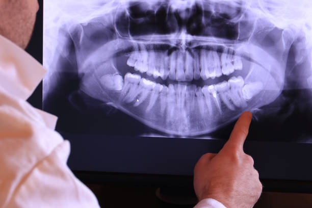 Best Knocked-Out Tooth (Avulsed Tooth) Treatment in Centerton, AR