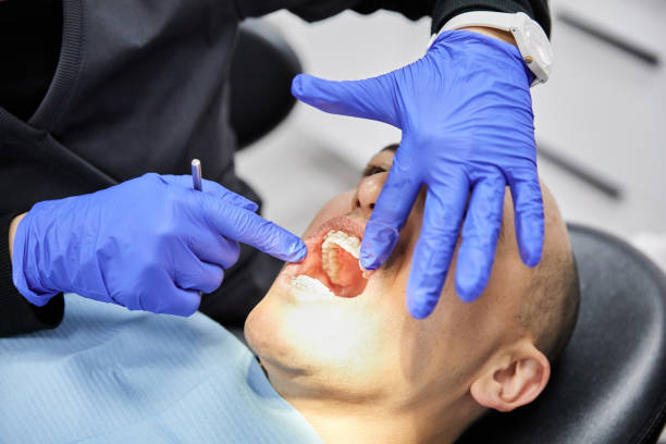Best Emergency Wisdom Tooth Extraction in Centerton, AR